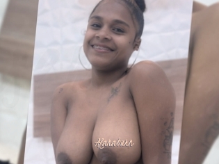Alanaburn