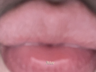Ynnax